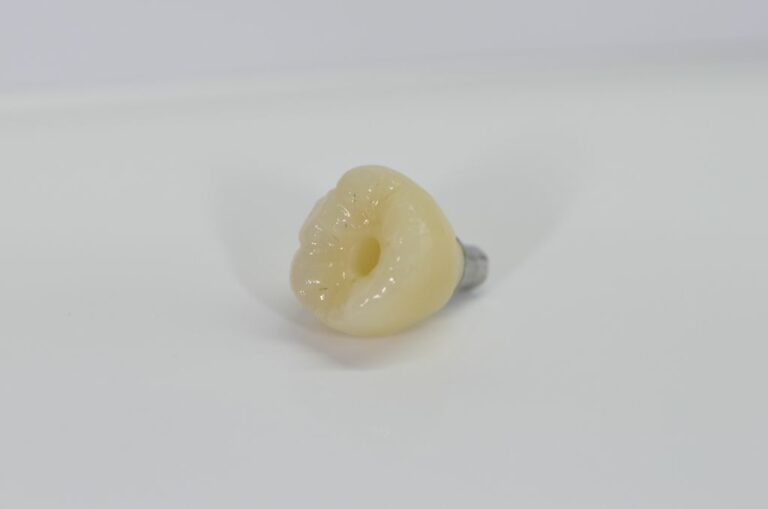 Pilier implantaire transvissé