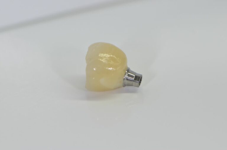 Pilier implantaire transvissé