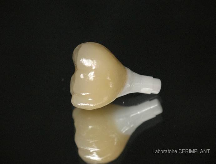 Pilier implantaire transvissé