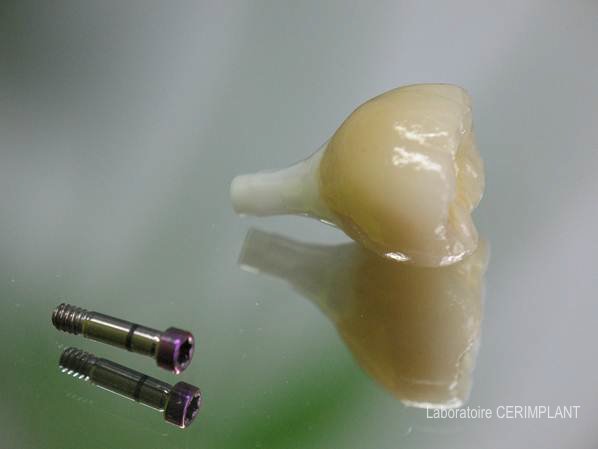 Pilier implantaire transvissé